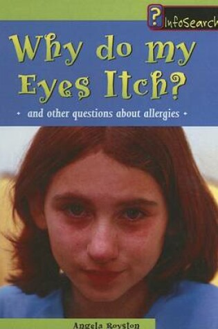 Cover of Why Do My Eyes Itch?