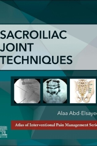 Cover of Sacroiliac Joint Techniques - E-Book