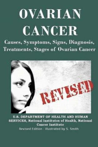 Cover of Ovarian Cancer