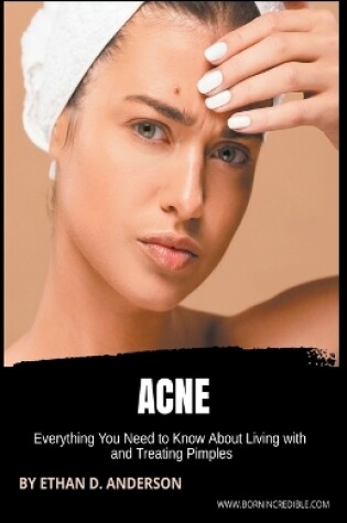 Cover of Acne