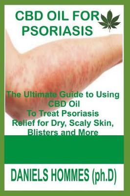 Book cover for CBD Oil for Psoriasis