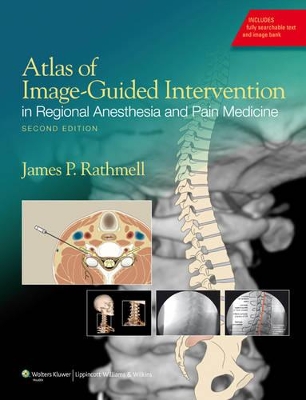 Book cover for Atlas of Image-Guided Intervention in Regional Anesthesia and Pain Medicine