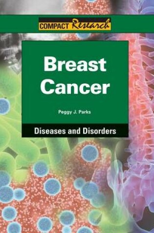 Cover of Breast Cancer