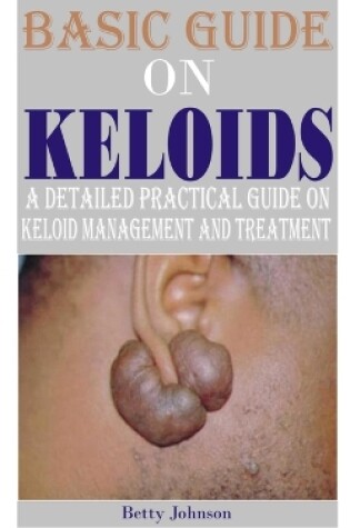 Cover of Basic Guide on Keloids