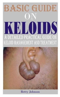 Book cover for Basic Guide on Keloids