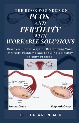 Book cover for The Book You Need on Pcos and Fertility with Solution