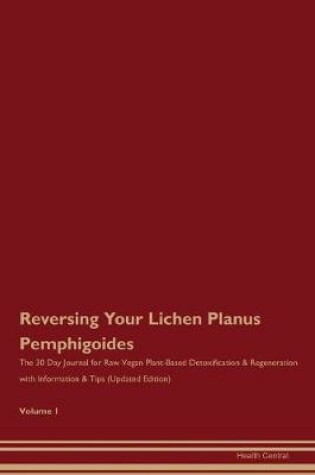 Cover of Reversing Your Lichen Planus Pemphigoides