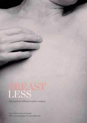 Cover of Breastless