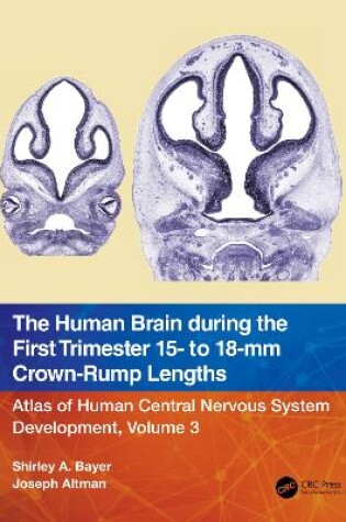 Cover of The Human Brain during the First Trimester 15- to 18-mm Crown-Rump Lengths