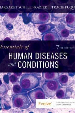 Cover of Essentials of Human Diseases and Conditions