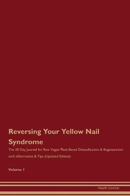 Book cover for Reversing Your Yellow Nail Syndrome