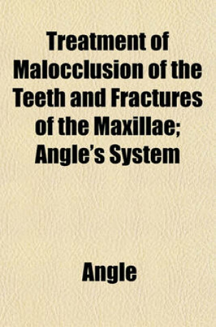 Cover of Treatment of Malocclusion of the Teeth and Fractures of the Maxillae; Angle's System