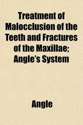 Book cover for Treatment of Malocclusion of the Teeth and Fractures of the Maxillae; Angle's System