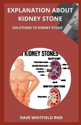 Book cover for Explanation about Kidney Stone