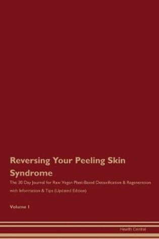 Cover of Reversing Your Peeling Skin Syndrome