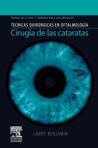 Cover of Cirugia de Cataratas