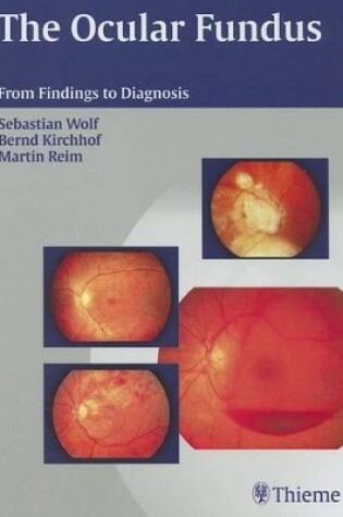 Cover of The Ocular Fundus