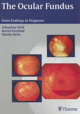 Cover of The Ocular Fundus