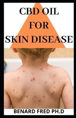 Book cover for CBD Oil for Skin Disease