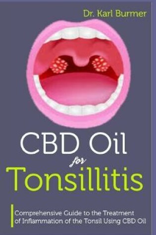 Cover of CBD Oil for Tonsillitis