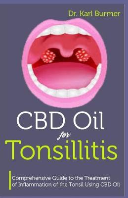 Book cover for CBD Oil for Tonsillitis