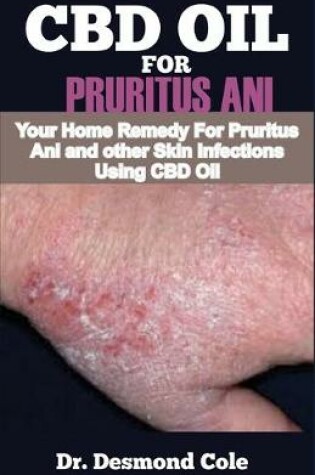 Cover of CBD Oil for Pruritus Ani