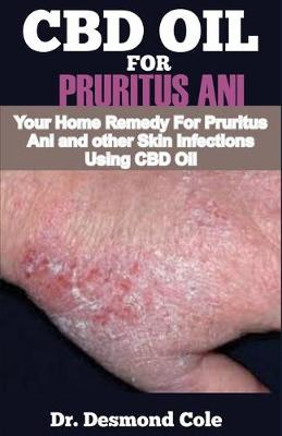 Book cover for CBD Oil for Pruritus Ani