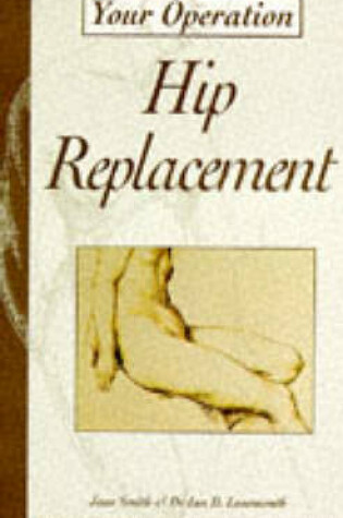 Cover of Hip Replacement