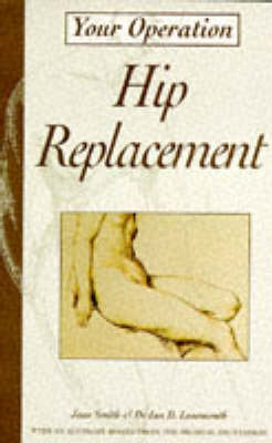 Cover of Hip Replacement