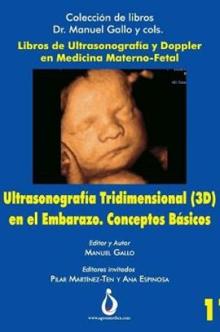 Cover of Ultrasonografia Tridimensional En El Embarazo (3d). Conceptos B sicos