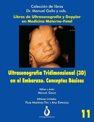 Book cover for Ultrasonografia Tridimensional En El Embarazo (3d). Conceptos B sicos