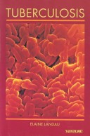 Book cover for Tuberculosis
