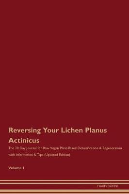 Book cover for Reversing Your Lichen Planus Actinicus