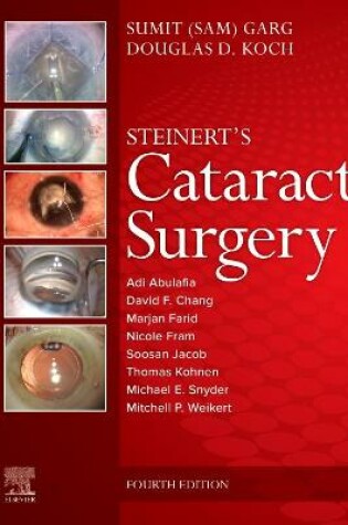 Cover of Cataract Surgery