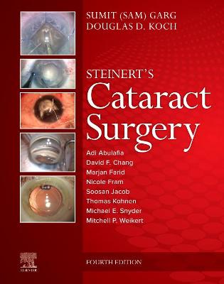 Cover of Cataract Surgery