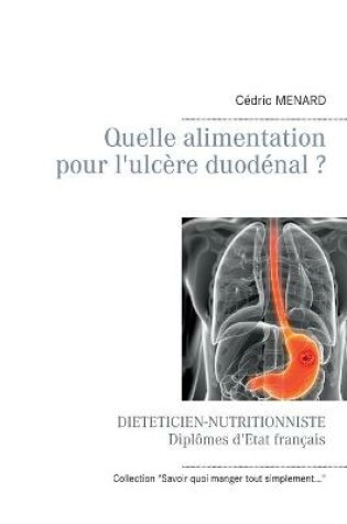 Cover of Quelle alimentation pour l'ulcère duodénal ?