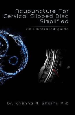 Book cover for Acupuncture for Cervical Slipped Disc Simplified