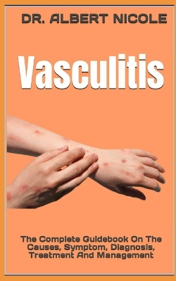 Book cover for Vasculitis