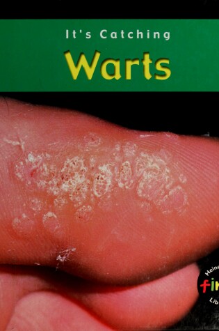Cover of Warts