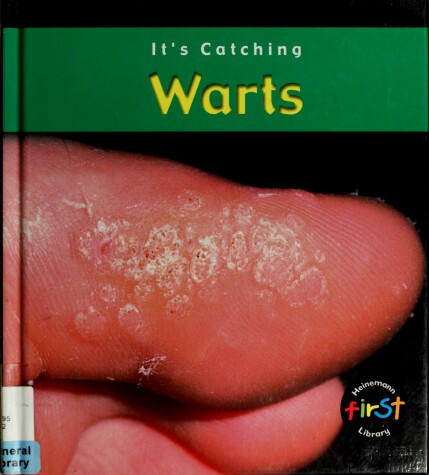 Cover of Warts