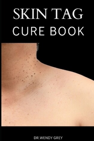 Cover of The Skin Tag Cure Book