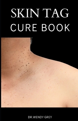 Book cover for The Skin Tag Cure Book