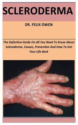 Book cover for Scleroderma