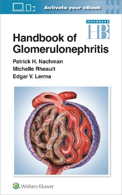 Cover of Handbook of Glomerulonephritis