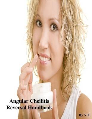 Book cover for Angular Cheilitis Reversal Handbook