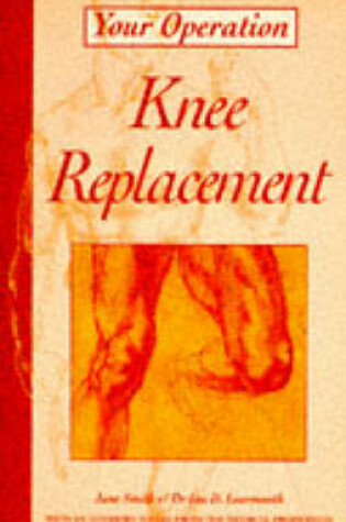 Cover of Knee Replacement