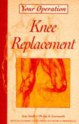 Book cover for Knee Replacement