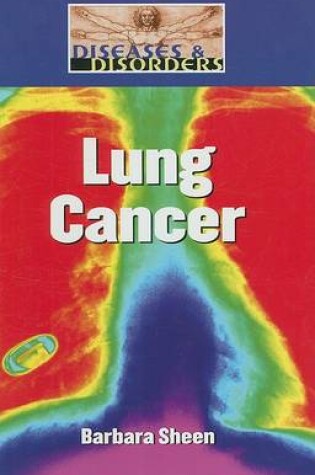 Cover of Lung Cancer