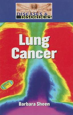 Book cover for Lung Cancer
