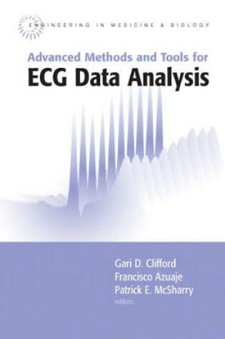 Cover of Advanced Methods and Tools for ECG Data Analysis